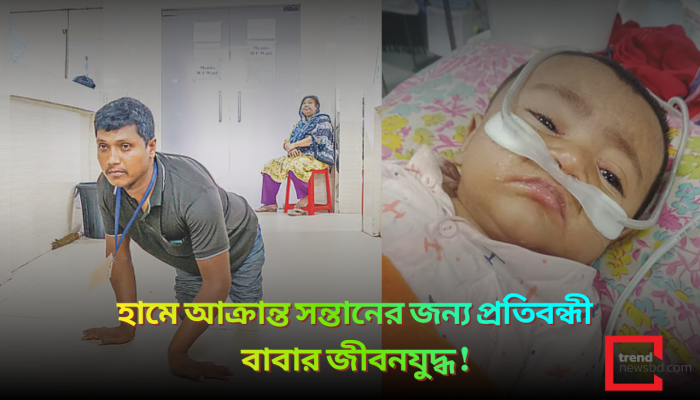 হামে আক্রান্ত সন্তানের জন্য প্রতিবন্ধী বাবার জীবনযুদ্ধ !
